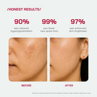 Alpha Arbutin Serum (30ml) – Dark Spot &amp; Even Tone Support | Faiza Glow
